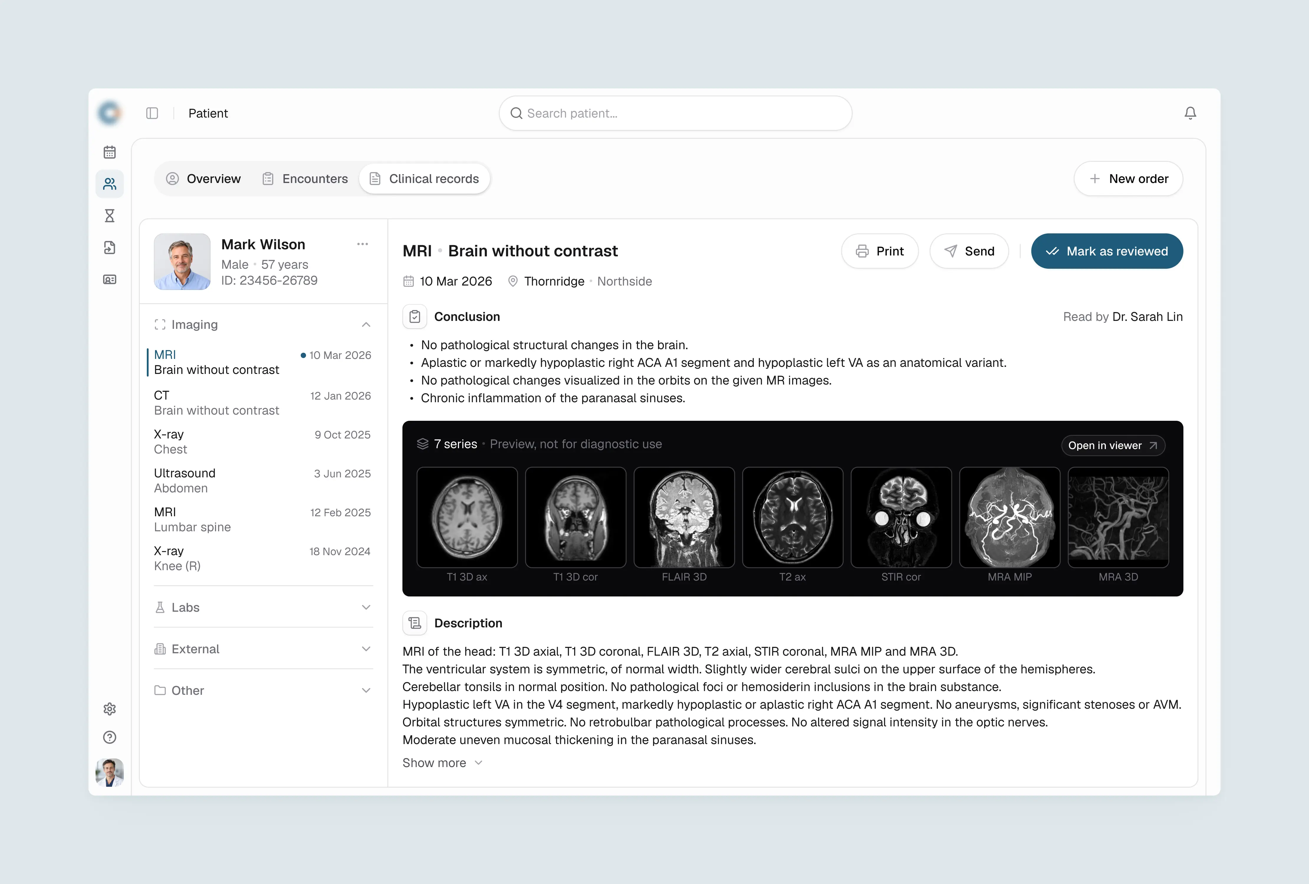 Clinical records interface with diagnostic report, image series and prior studies